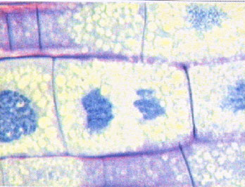 meristematic-parenchyma.-ed.jpg